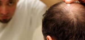 كيفية إحياء بصيلات الشعر وتقويتها